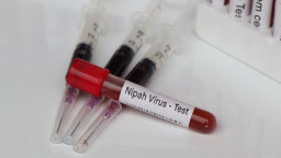 Kenali Gejala Wabah Nipah di India, Mirip Influenza dan Demam: Indonesia Perlu Waspada?