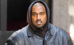 Bukan Main, Kanye West Cari Suasana Baru, Pasang Gigi Titanium Rp13 Miliar