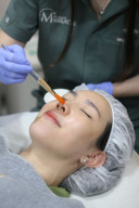 Pendekatan Menyeluruh Miracle Aesthetic Clinic, Tangani Hiperpigmentasi Kulit Pelanggan Indonesia