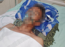 Tahanan Polres Blitar Tewas Usai Dianiaya Sesama Tahanan