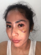 BAP Janggal, Korban Penganiayaan Buka Suara