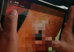 6 Warga Tulungagung Diduga Tertular Antraks