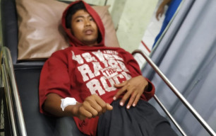 Jadi Korban Pembacokan, Pemuda di Jombang Alami Luka Tangan, 2 Pelaku Diringkus