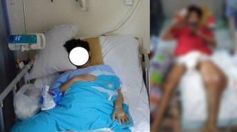 Viral Kasus Bullying di Sekolah, Kaki Siswa SD di Tambun Bekasi Terinfeksi dan Terancam Diamputasi