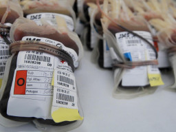 Golongan Darah Timbulkan Risiko Kesehatan yang Berbeda-Beda