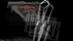 Dicekoki Miras, Gadis di Jombang Diperkosa Tujuh Pemuda