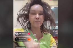 Penampilan Bunda Corla Pasca Operasi Face Lift Disorot: Inilah Wajah Bunda Terpaling Jelek