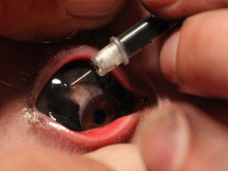 Tato Mata Dapat Sebabkan Infeksi dan Kebutaan