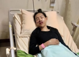 Dijambret di MERR, Mahasiswi Patah Tulang Rahang