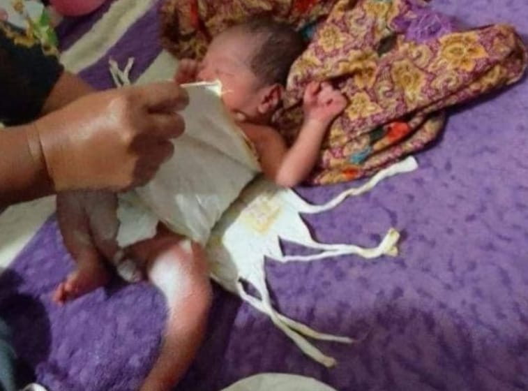 Bayi yang berhasil diselamatkan