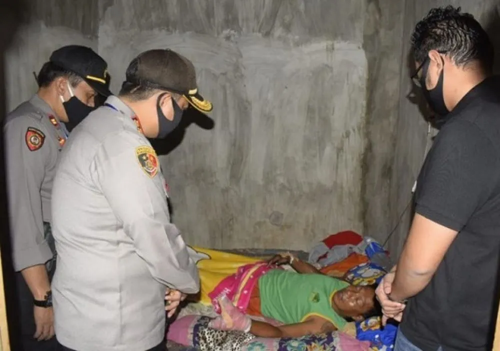 Karena Kembang Api, Jemari Pria di Pasuruan Hancur