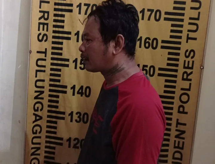 Ditonjok Hingga Gigi Tanggal, Lapor Polisi