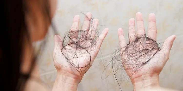 Muncul Gejala Rambut Rontok Parah Pasca Terinfeksi Covid-19
