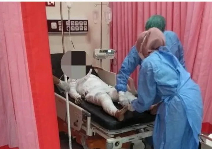 Diduga karena Urusan Ranjang, Suami Bakar Istri Siri