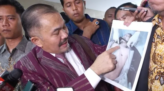 Banyak Temuan Baru, Kuasa Hukum Keluarga Brigadir J Beberkan Hasil Autopsi Kedua