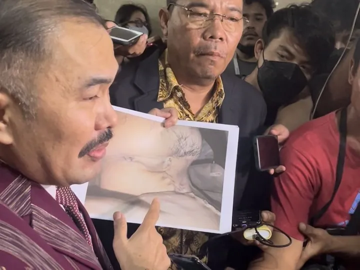 Tembakan ke Brigadir J dari Belakang Kepala