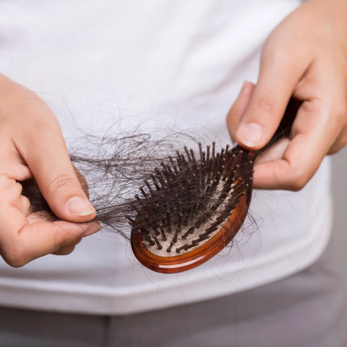 Tips dan Trik Atasi Rambut Rontok