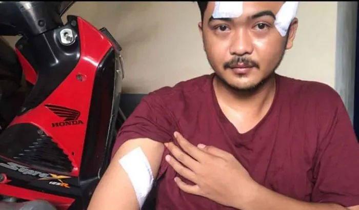 Pegawai SPBU di Sidoarjo Dibacok Orang