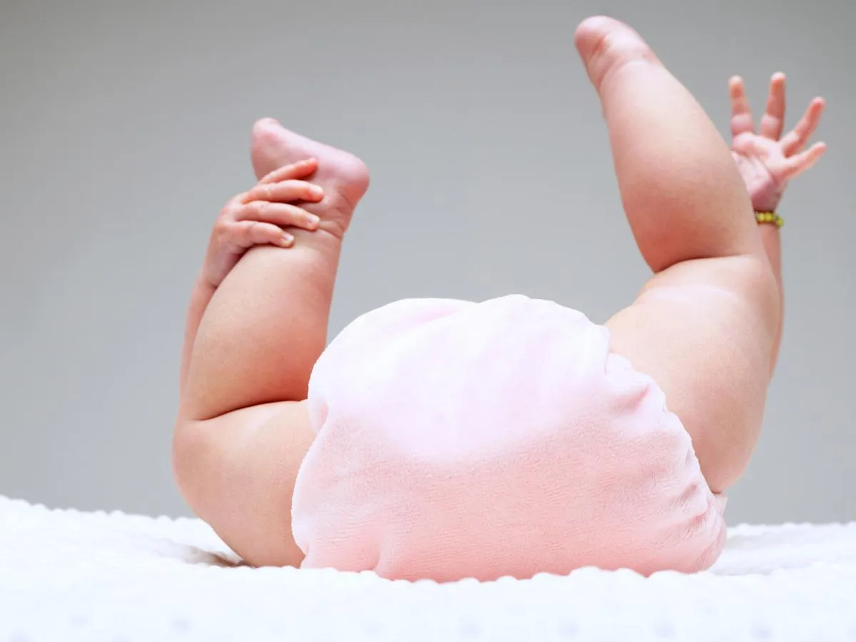 IDAI: Tips Atasi Ruam Popok pada Anak