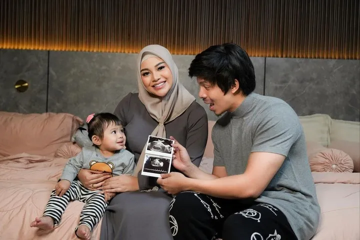 Aurel Hermansyah Umumkan Hamil Anak Kedua, Begini Kondisinya...