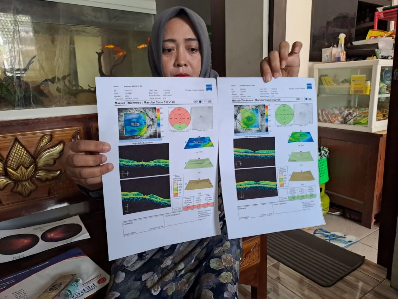 Polisi Naikkan Status Kasus Pelajar SD di Jombang yang Retina Matanya Rusak Terlempar Kayu
