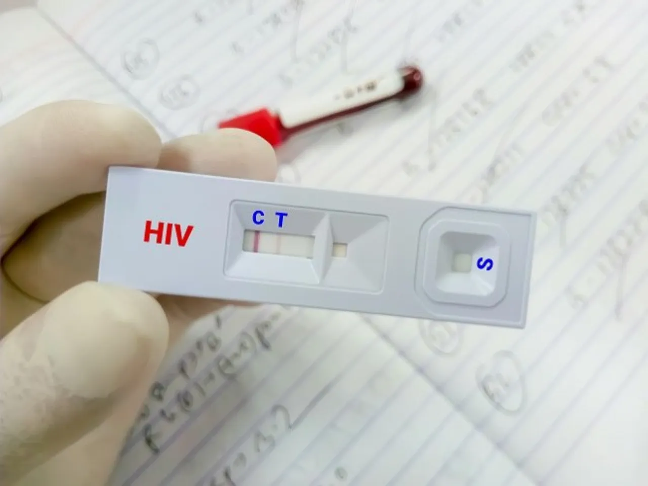 Singapura, Sudah Buka Tes HIV Mandiri