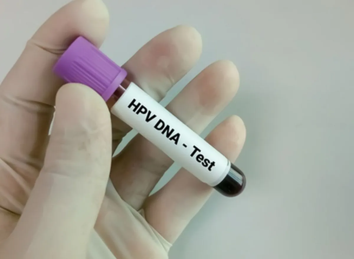 Dinkes Tuban Gencarkan Screening HPV DNA, Targetkan 8000 Peserta