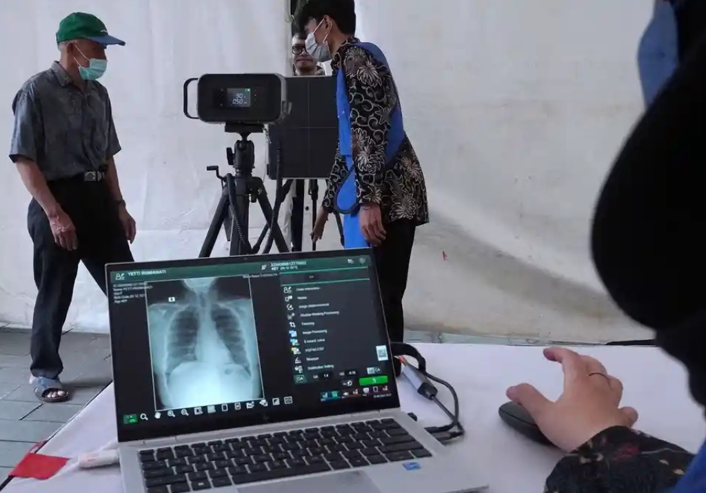 Seorang warga menjalani pemeriksaan kesehatan sebagai upaya deteksi dini tuberkulosis (TBC) melalui Skrining TBC dengan Mobile X-Ray. SP/ MLG