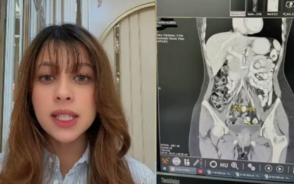 Sosok Konten Kreator, Fahira Almira yang viral setelah membagikan pengalaman kesehatan yang dialaminya. Second opinion pemeriksaan usus buntu ke Penang Malaysia disorot.