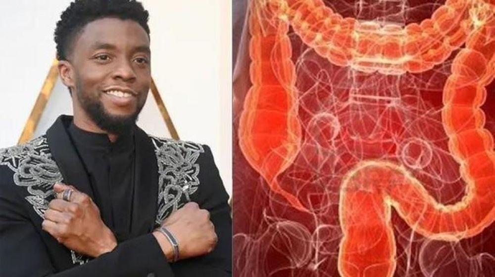 Chadwick Boseman meninggal dunia akibat kanker usus besar. SP/ CNN