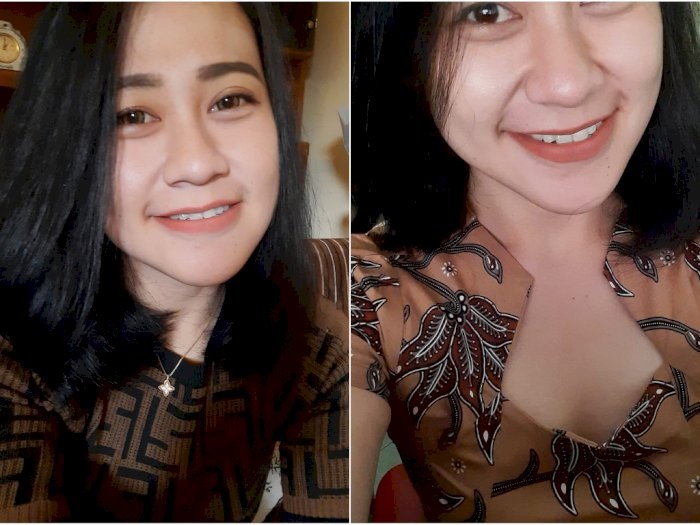 Eva Sofiana Wijayanti, perawat salah satu klinik kecantikan di Malang yang menjadi korban pembakaran oleh pria tak dikenal.