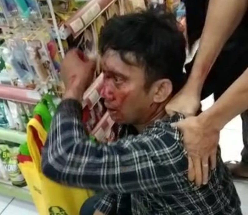 Pelaku saat babak belur dihajar massa. 