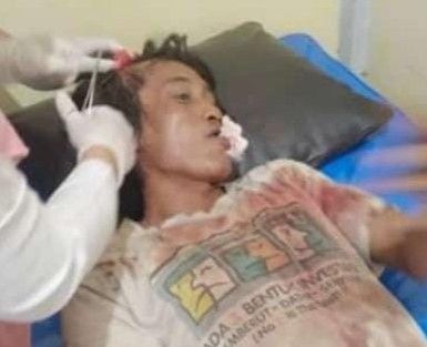 Korban Mujiono sebelum meninggal masih sempat dirawat di RSUD Ibnu Sina Gresik. 