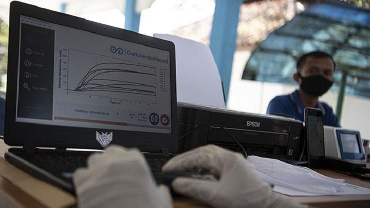 Petugas saat menganalisis sampel pemeriksaan covid-19 menggunakan sistem GeNose. SP/ Antara