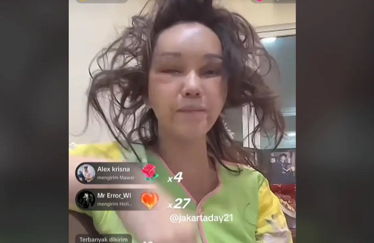 Penampilan Bunda Corla terbaru pasca operasi, nampak bengkak. SP/ JKT