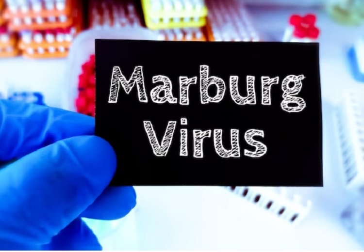 Illustrasi penyakit virus marburg (MVD). SP/ SBY