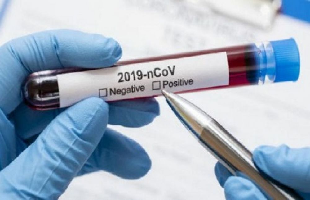 Illustrasi positif corona. SP/Lim